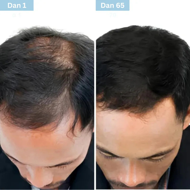 Daynava™ Roll-On za rast kose