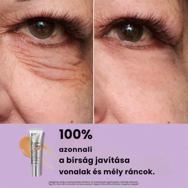 Daynava™ Azonnali Szemkörnyék-Lifting